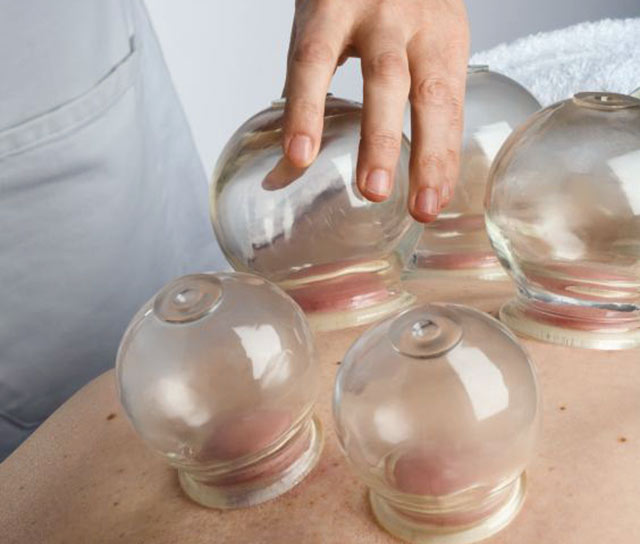 Cupping And Gua Sha In Dallas Southwest Acupuncture Clinic